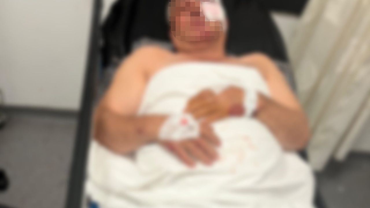 Aydın'daki gizemli motosiklet kazasında kardeş kavgası iddiası