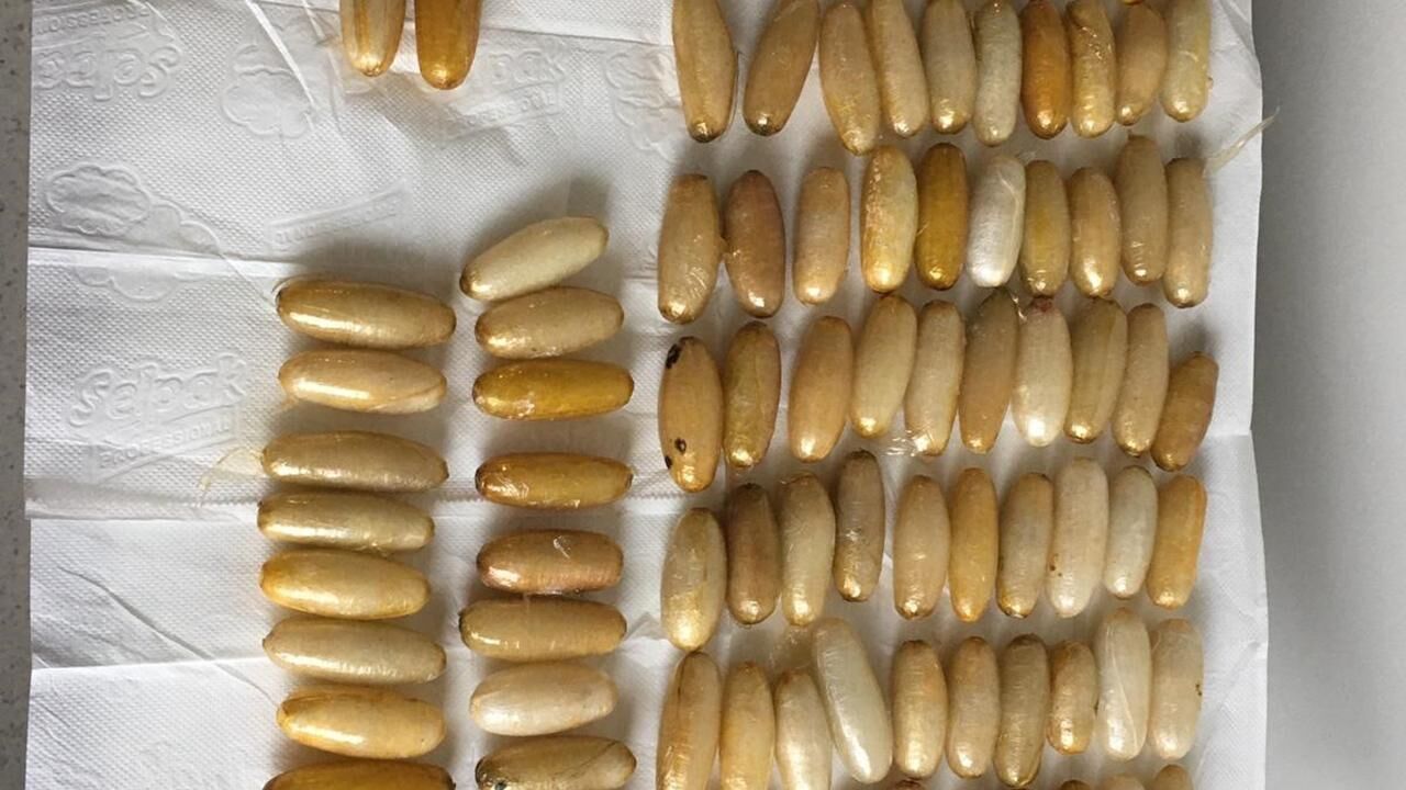 İzmir Havalimanında film gibi operasyon: Midesinden çıkanlar şoke etti