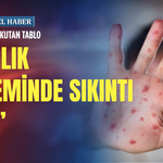 Kızamıkta korkutan tablo: Sağlık sisteminde sıkıntı var!
