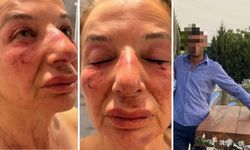 İzmir’de kan donduran saldırı! Hayvansever eczacıyı kemerle boğmaya çalıştı