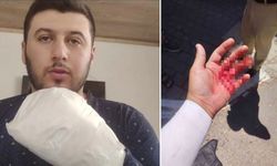Motokuryeye döner bıçaklı saldırı: Kuryenin parmakları koptu