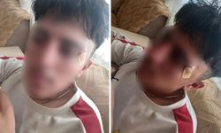 Öğretmenin kafa attığı 16 yaşındaki çocuğun burnu kırıldı