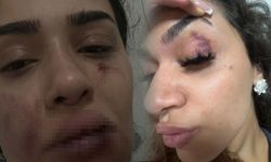Uzaklaştırma kararı da yetmedi! Ebru hemşireden yardım çığlığı: Ben öldükten sonra mı adalet sağlanacak