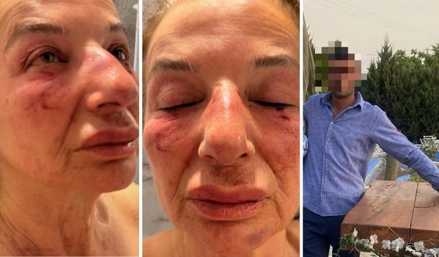 İzmir’de kan donduran saldırı! Hayvansever eczacıyı kemerle boğmaya çalıştı