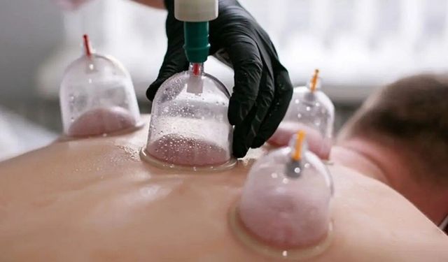 Hacamat uygulamasında hekim kontrolü ve steril ortamda yapılmalı
