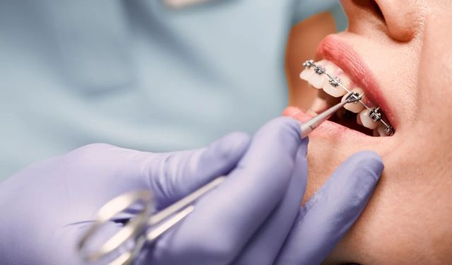 Diş hekimliğinde kontenjan tartışması! İZDO Başkanı Atinel: Nitelik esas alınmalı