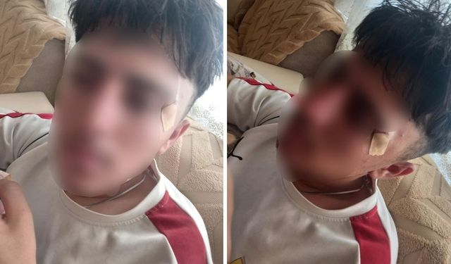 Öğretmenin kafa attığı 16 yaşındaki çocuğun burnu kırıldı