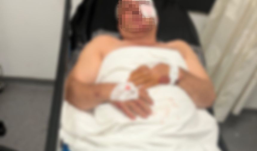 Aydın'daki gizemli motosiklet kazasında kardeş kavgası iddiası