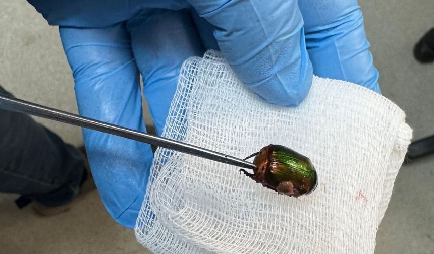 Kulağındaki ağrının sebebi 'Japon böceği' çıktı
