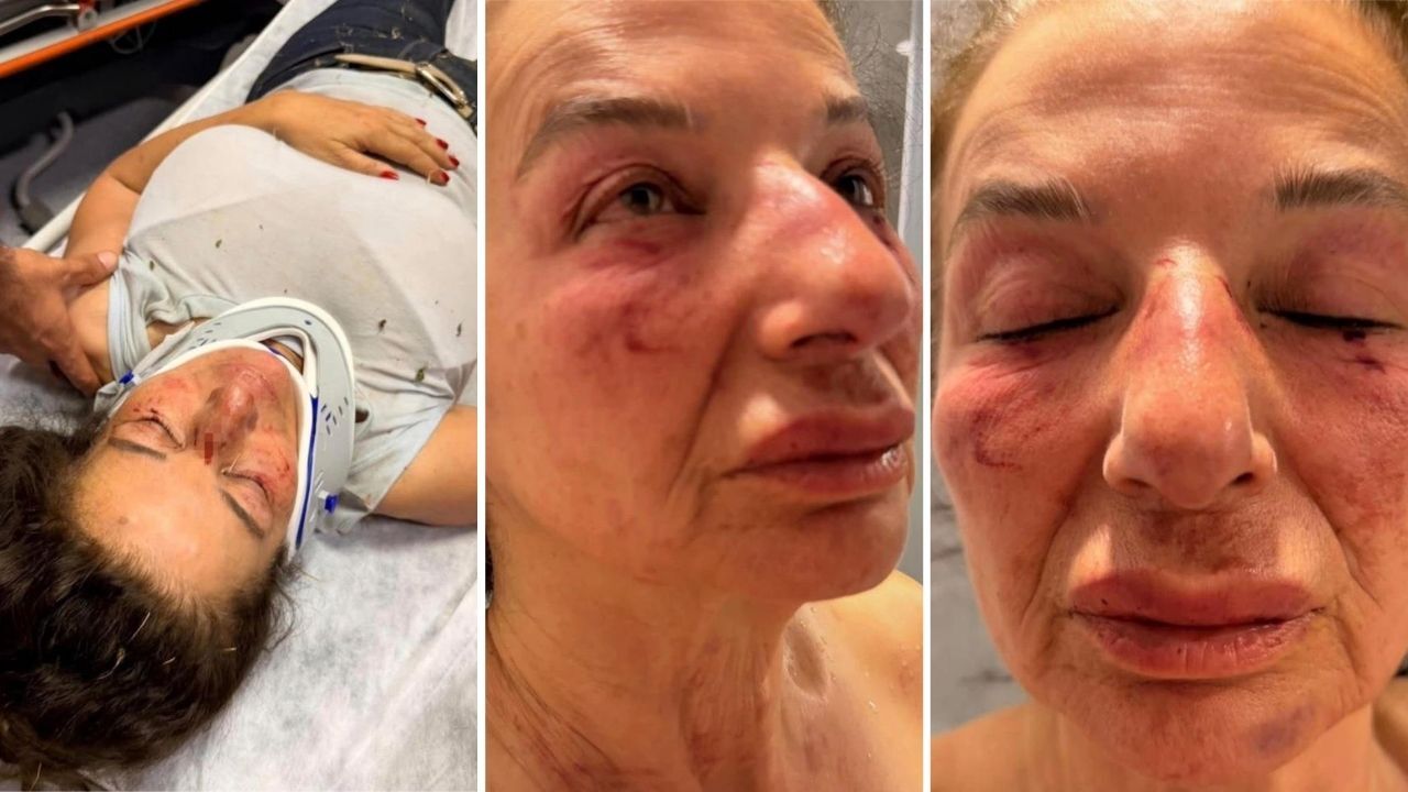 İzmir’in Selçuk ilçesinde hasta bir sokak köpeği ihbarı üzerine bölgeye giden eczacı ve hayvan hakları savunucusu Beray Yürek, iddiaya göre tuzağa düşürülerek dövüldü ve kemerle boğulmaya çalışıldı. Olayın ardından gözaltına alınan şüpheli tutuklanırken, Efes Selçuk Belediye Başkanı Filiz Ceritoğlu Sengel, konuyla ilgili açıklama yaptı.