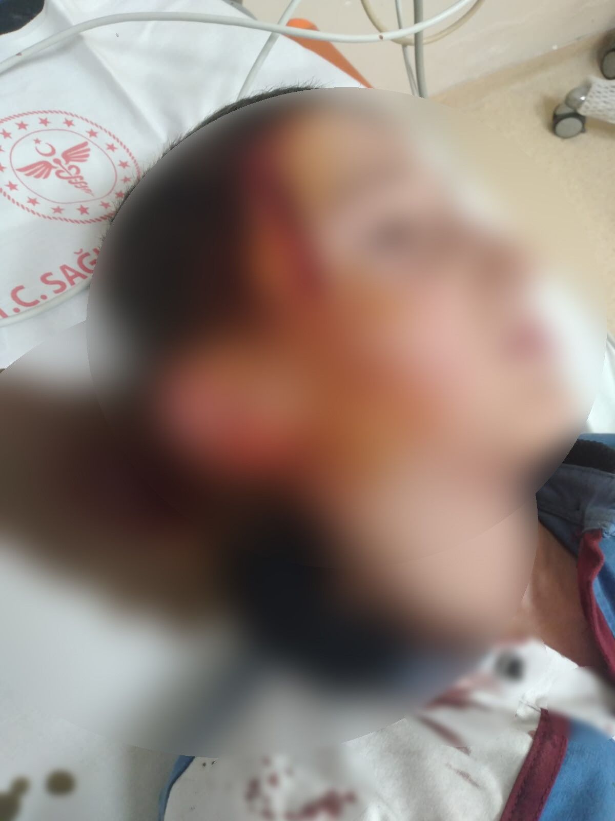 İzmir’de Köpek Saldırısı Davasında Rekor Tazminat Hayvan Sahibine 1,2 Milyon Tl Ceza (2)