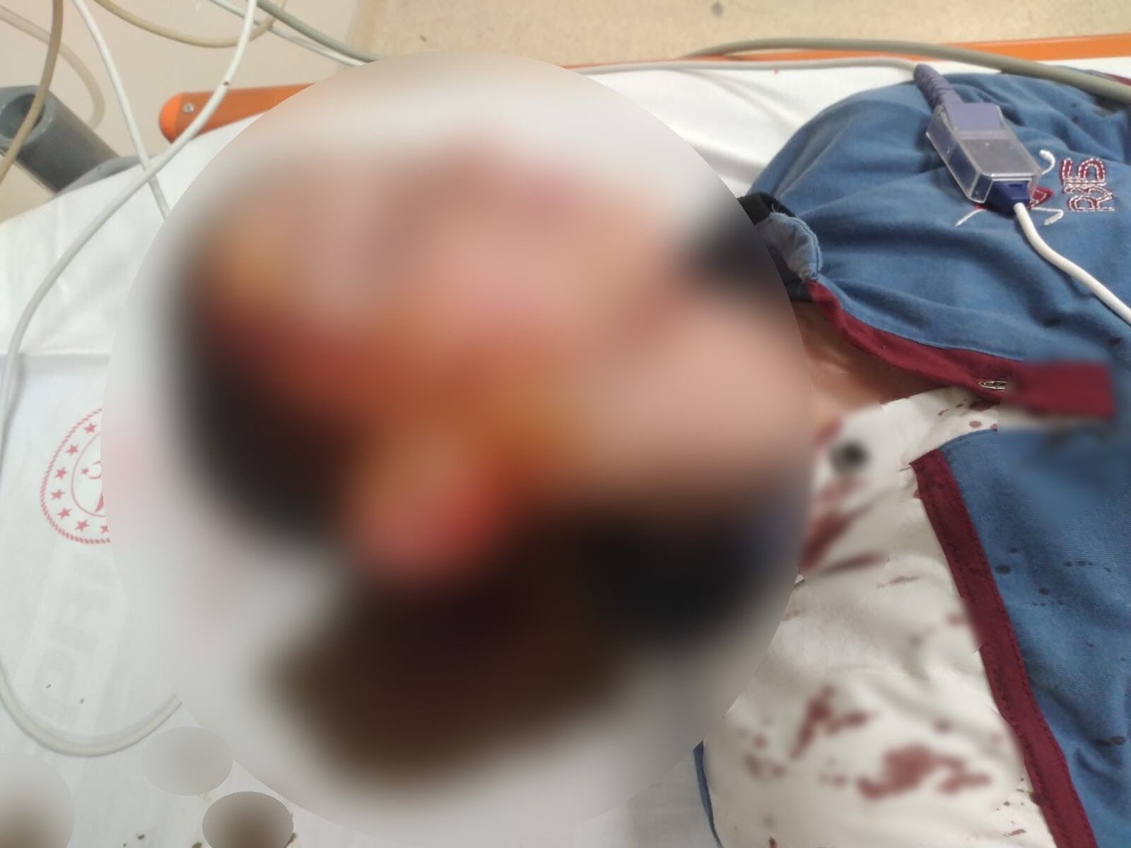 İzmir’de Köpek Saldırısı Davasında Rekor Tazminat Hayvan Sahibine 1,2 Milyon Tl Ceza (4)